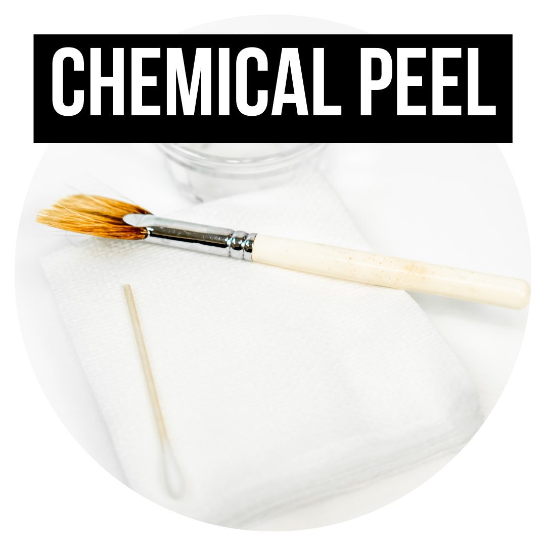 CHEMICAL PEEL